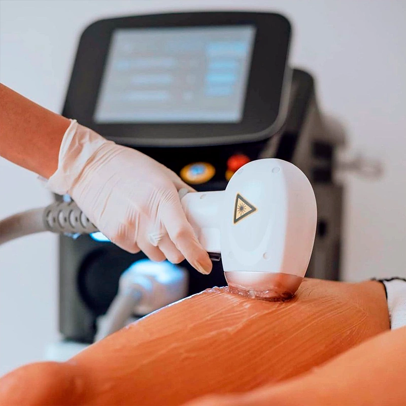 Depilación Definitiva